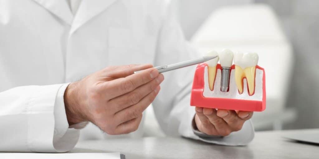 a dentist holding a dental implant model